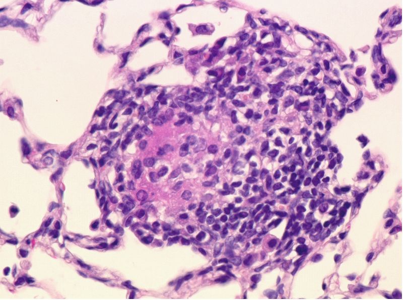 Propionibacteria Propionibacteria